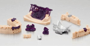 impression 3D dentaire
