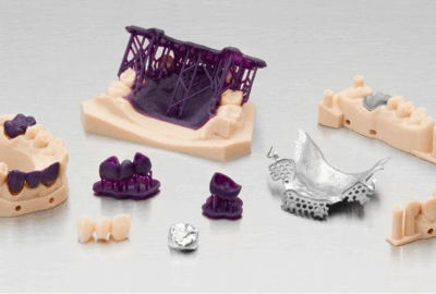 impression 3D dentaire