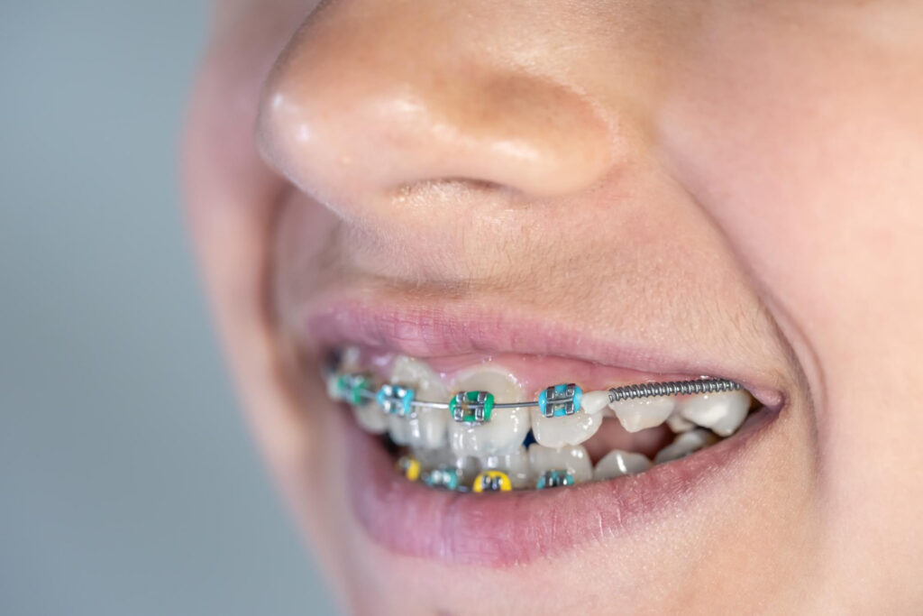 Orthodontie et santé