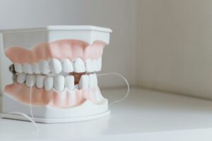 Dentiste à Vitrolles : modèle de mâchoire au cabinet