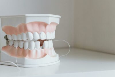 Dentiste à Vitrolles : modèle de mâchoire au cabinet